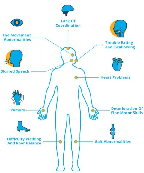 Ataxia | Parkinsons Disease and Movement Disorders Clinic